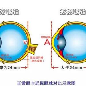 碧波眼鏡價格