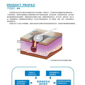 負(fù)壓引流護(hù)創(chuàng)材料吉林省火熱招商