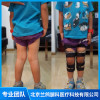 北京兒童X型腿矯正 成人X型腿矯正 X型腿矯正哪家醫院好 北京蘭鴿腿科醫療